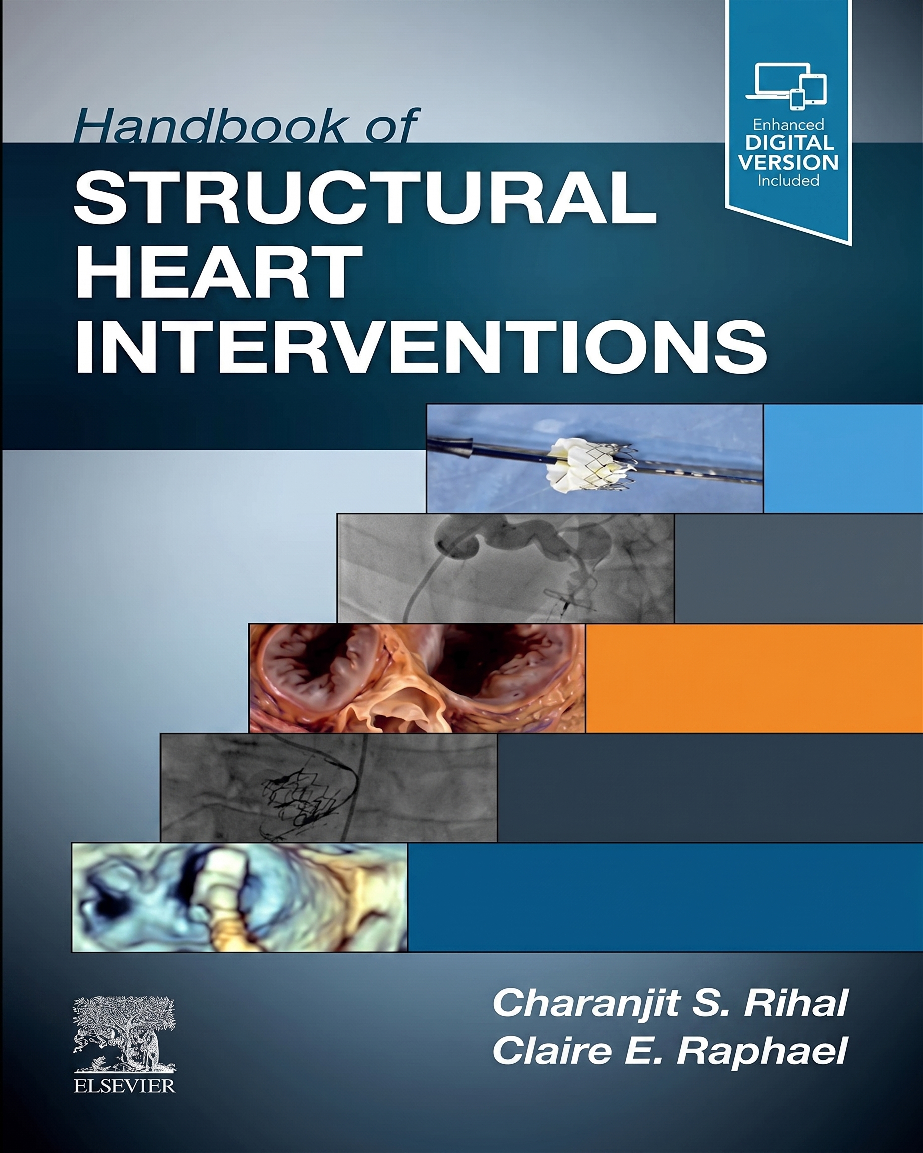 Handbook of Structural Heart Interventions
