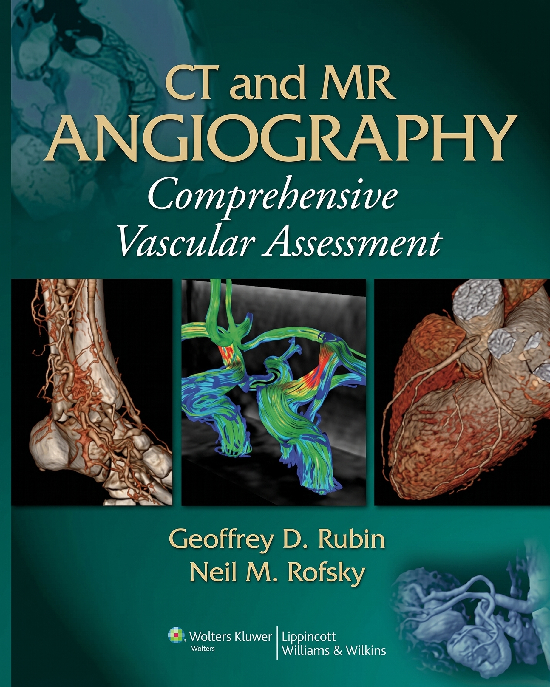 Ct And Mr Angiography: Comprehensive Vascular Assessment