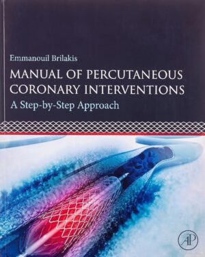 Manual of Percutaneous Coronary Interventions: A Step-by-Step Approach